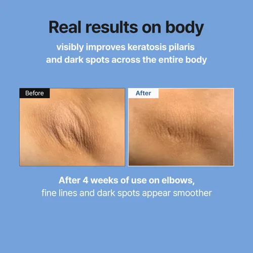Vista 4 de MEDITHERAPY Retinal Skin Booster Serum - Retinaldehído no irritante para principiantes para cara y cuerpo - Minimizador de poros de retinol