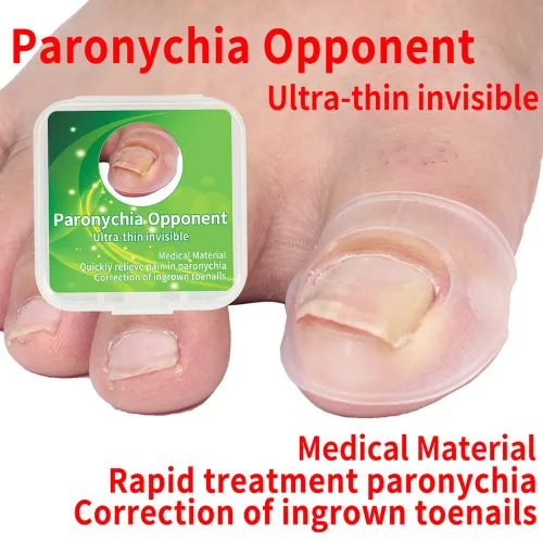 Vista 2 de Corrector de uñas encarnadas, 2 piezas de herramienta de corrección de uñas encarnadas de silicona, corrector de uñas encarnadas, tratamiento