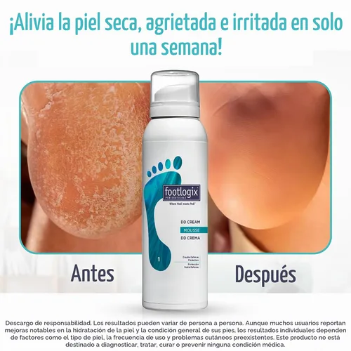 Vista 3 de FOOTLOGIX DD Cream Mousse, blanco, 4.23 onzas