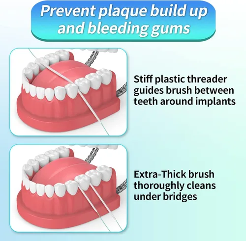 Vista 2 de Hilo de esponja fácil de usar para la limpieza de implantes puentes con extremos de plástico rígido e hilo de esponja higiene bucal (1)