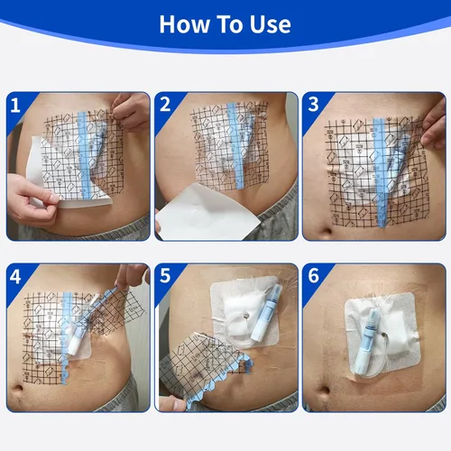 Vista 5 de 50 protectores impermeables para cubierta de ducha de puerto de diálisis, cubierta de tatuaje, catéter PD, protector de ducha, diálisis peritoneal