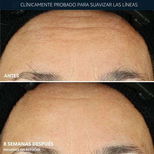 Vista 4 de RoC Retinol Correxion Suero de Noche Anti-Envejecimiento contra Arrugas, Suero de Retinol para el Rostro, Tratamiento Diario para Líneas Finas