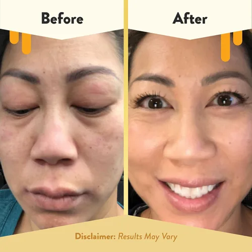 Vista 6 de ECZEMA HONEY Limpiador facial de avena - Crema facial calmante - Paquete para pieles sensibles y secas - Libre de crueldad