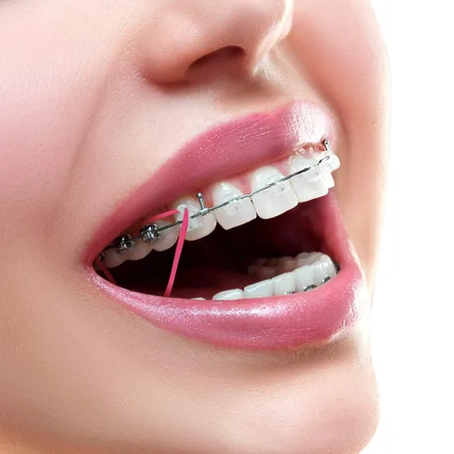 Vista 5 de Annhua Bandas elásticas de ortodoncia, 500 unidades (3.5 onzas, 1/4 pulgadas), bandas de tracción de goma dental, bandas para huecos dentales, aseo
