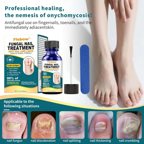 Vista 3 de Tratamiento de hongos en las uñas de los pies, tratamiento de hongos en las uñas extra fuerte para uñas, amarillas, decoloradas, uñas rotas