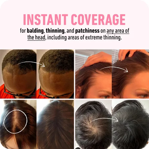 Vista 3 de BOLDIFY Polvo de línea capilar (gris), fórmula instantánea a prueba de manchas de 48 horas que se bloquea para cabello de cuerpo completo y barba