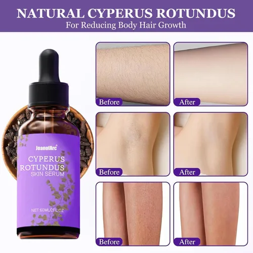 Vista 2 de Cyperus Rotundus - Suero para la piel, aceite Cyperus Rotundus para depilación, aceite corporal calmante hidratante orgánico natural, hidratante e