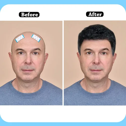 Vista 6 de 8 piezas de cinta frontal de encaje de doble cara, impermeable, cinta adhesiva para pelucas, tupés, piezas de cabello y extensiones de cabello