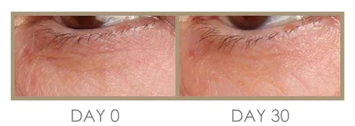 Vista 3 de Genie H 'Eye 'drator Eye Crema