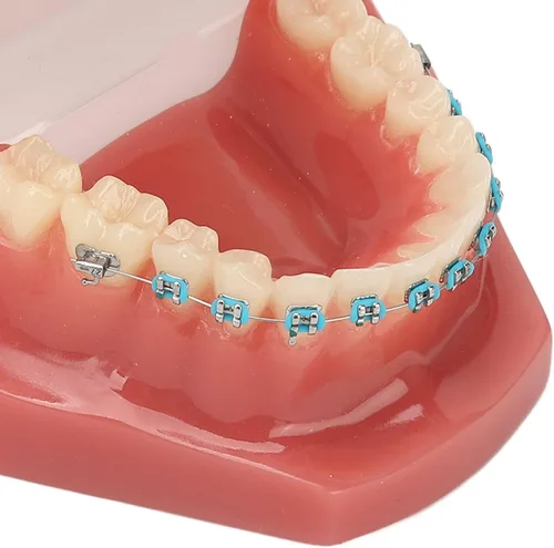 Vista 7 de Modelo de cuidado de dientes, 28 piezas de resina de dientes enseñanza con soportes de metal, modelo de dientes para estudiantes, modelo de dientes