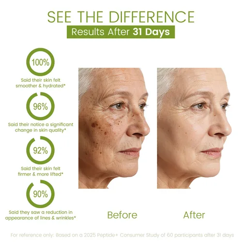 Vista 5 de AOAO Crema de estiramiento facial para mujeres, reafirma y nutre la piel, niacinamida para hidratar, suavizar la piel áspera, tratamiento hidratante