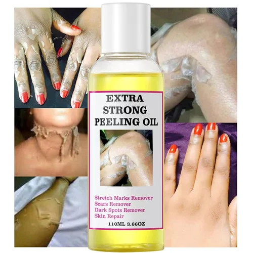 Vista 8 de Generic Aceite pelador amarillo extra fuerte para piel oscura, solución exfoliante para cuerpo, manos, pies y cara, todo