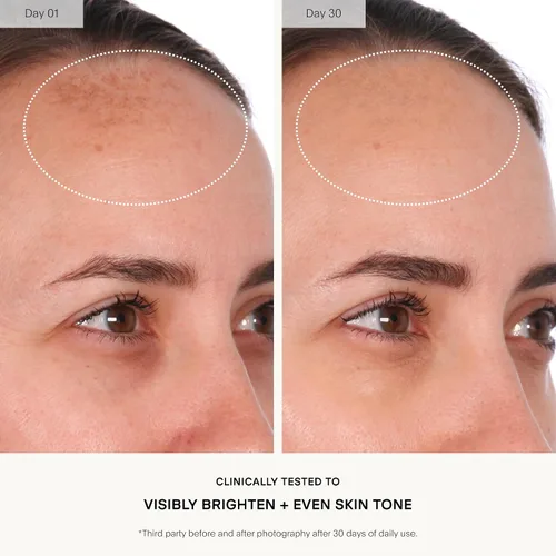 Vista 4 de U Beauty Suero Compuesto Resurfaceador - Renueva e Ilumina el Suero Facial - Fórmula Avanzada 8 en 1 con Vitamina C, Retinol, Ácido Hialurónico