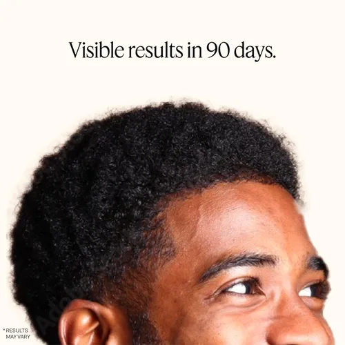 Vista 6 de OMI WELLBEAUTY - Péptidos para el crecimiento del cabello para hombre, recomendado por médicos, biotecnología fortificante de folículos