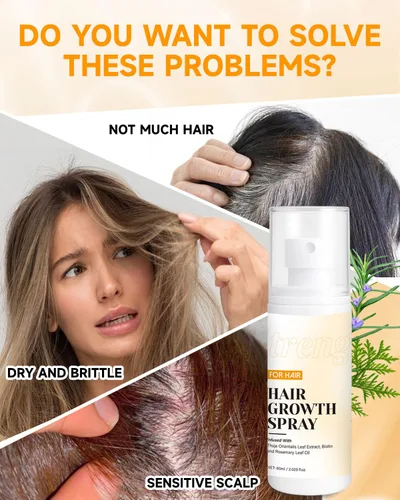 Vista 2 de Spray para el crecimiento del cabello, aceite en aerosol para el crecimiento del cabello, con Biota Orientalis, aceite de romero y biotina