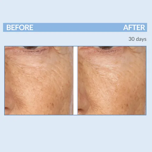 Vista 4 de Serious Skincare Un trío Defiance para cara y cuello – Anti-envejecimiento para líneas finas y arrugas – A Force XR Retinol Serum 1 oz – 4 millones