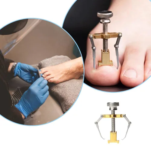 Vista 3 de Corrector de uñas encarnadas profesional encarnadas levantador de uñas encarnadas práctica abrazadera para el tratamiento de uñas encarnadas