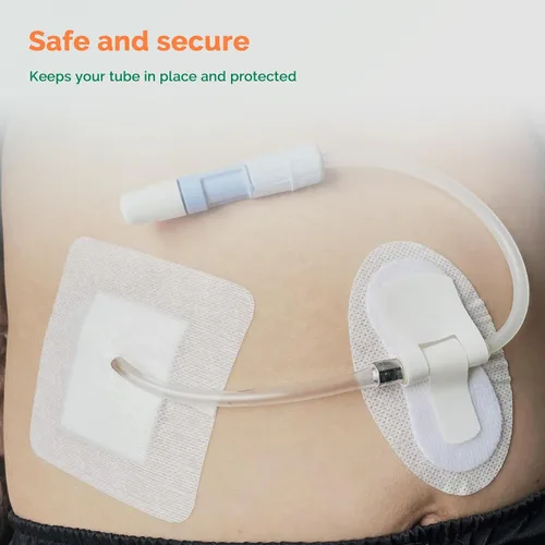 Vista 6 de Tiras adhesivas de drenaje divididas 10 x 10 cm 10 piezas Apósitos para tubo de alimentación de catéter PD Almohadillas para tubo G Cubiertas