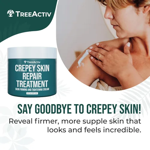 Vista 3 de TreeActiv Crepey Skin Repair Treatment, 8oz, crema reafirmante para cara y cuello, loción reafirmante y tensora de la piel con ácido hialurónico