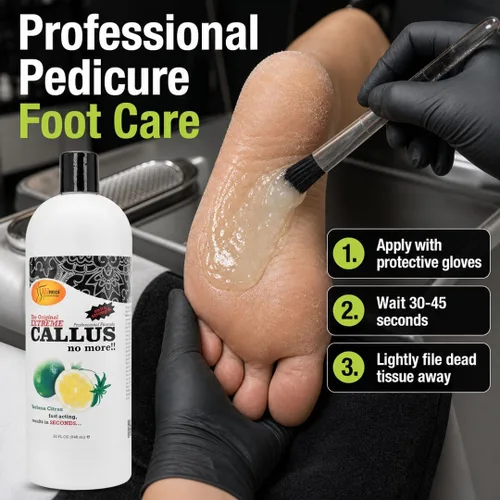 Vista 4 de SPA REDI - Gel removedor de callos para pies - Cuidado profesional de pies de pedicura - Elimina los callos más duros en segundos y suaviza los Lima