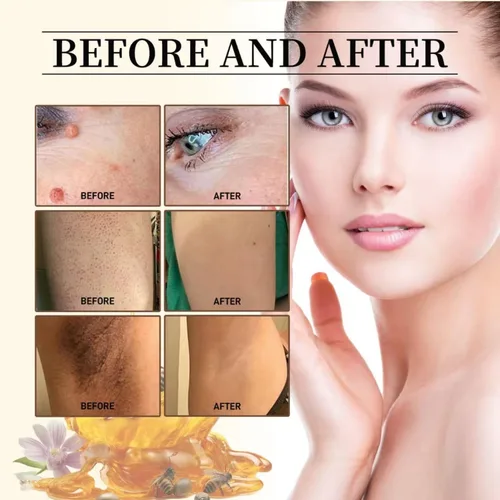 Vista 6 de Bee Venom Cream, nueva crema reparadora de tratamiento de la piel para todas las partes del cuerpo, gel de miel suave profesional para todo