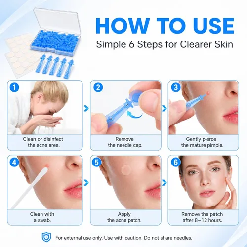 Vista 4 de 50 parches desechables para espinillas de hidrocol y 72 puntos de aguja para acné Ultrafine Pimple Popper Needle Clear Blemishes Milia; Calendula