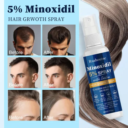 Vista 4 de Suero en Spray de Crecimiento Capilar con 5% de Minoxidil, Tratamiento para el Recrecimiento del Cabello para Hombres y Mujeres, Fortalece y Engrosa