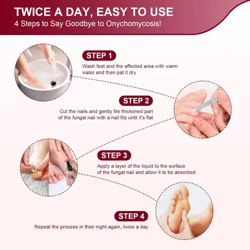 Vista 3 de Tratamiento de hongos en las uñas de los pies, tratamiento extra fuerte con 25% de ácido undecilénico, tratamiento de hongos en uñas dañadas, uñas