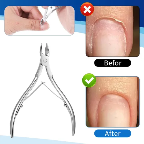 Vista 6 de Kit de herramientas de pedicura para quitar uñas encarnadas, de acero inoxidable, lima y levantadores de uñas, herramienta profesional de pedicura