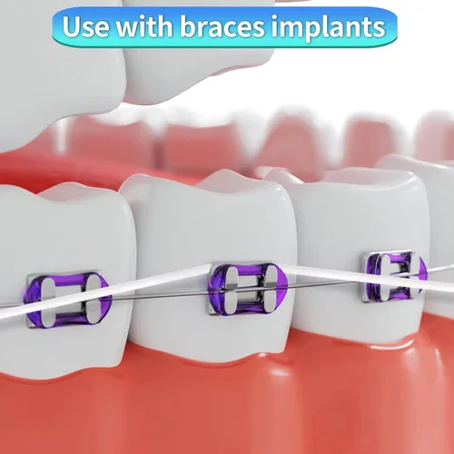 Vista 3 de Hilo de esponja fácil de usar para la limpieza de implantes puentes con extremos de plástico rígido e hilo de esponja higiene bucal (1)