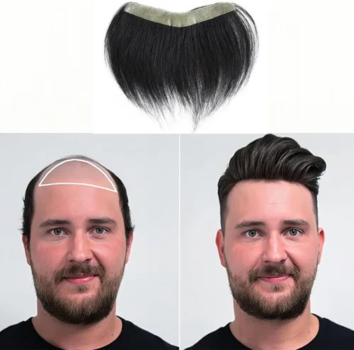 Vista 26 de Extensión frontal de cabello rubio claro para hombres, extensión de cabello lacio con pérdida de línea de cabello humano con cinta adhesiva