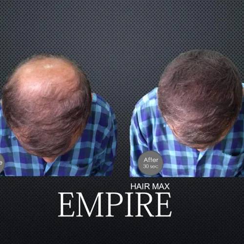 Vista 5 de Empire Hair Max - Corrector de pérdida de queratina para aumentar la pérdida de queratina (0.88 onzas) (gris)