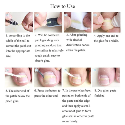 Vista 6 de Tiras correctoras de uñas encarnadas Brace 10 unids/botella enderezadora clip curvado BS Brace uñas de los pies gruesa corrección herramienta de pie
