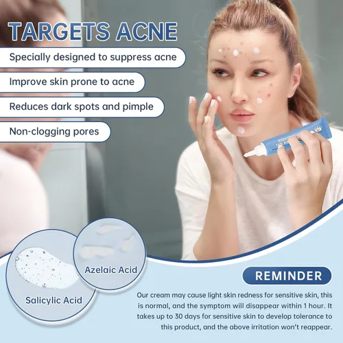Vista 4 de Crema de ácido azelaico 14% para aliviar el enrojecimiento, manchas oscuras, suero facial con niacinamida y vitamina C previene brotes de acné
