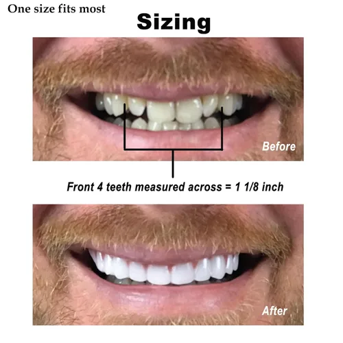Vista 9 de Instant Smile Ajuste Cómodo Flex Tono Natural