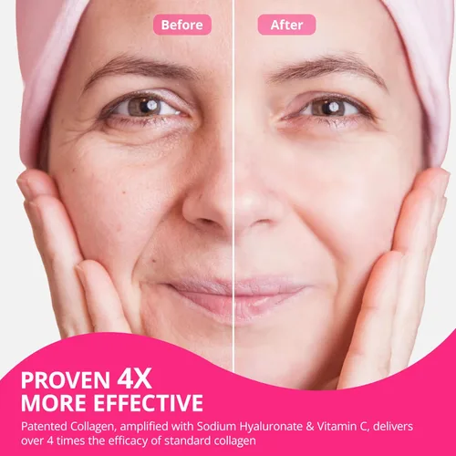 Vista 8 de Polvo de colágeno para mujeres, péptidos de colágeno en polvo con probióticos, proteína de colágeno prebiótica para piel, cabello, huesos