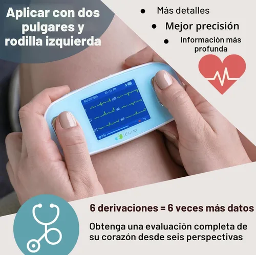 Vista 3 de EMAY 6L Monitor ECG portátil Graba ECG y frecuencia cardíaca en 6 canales Compatible con Smartphone y PC No se requiere suscripción