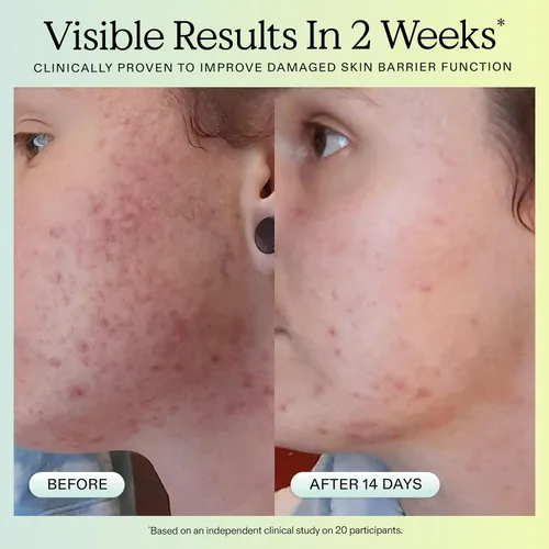 Vista 6 de KraveBeauty Great Barrier Relief Serum - Suero reparador de barrera inspirado en Corea, aceite de tamanu, alivia el enrojecimiento e hidrata, vegano
