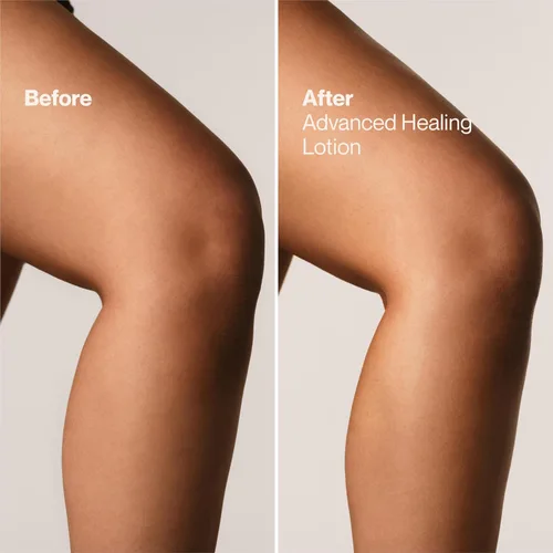 Vista 7 de Suave + Loción curativa avanzada para manos y cuerpo para mujeres con ceramidas para piel muy seca, hidratante, no grasosa, crema hidratante sin