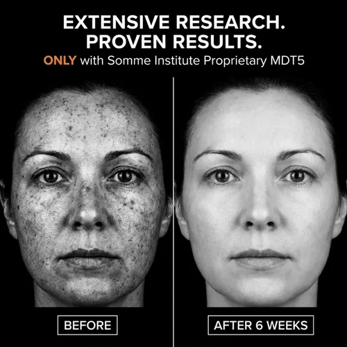 Vista 4 de Almohadillas exfoliantes de ácido glicólico, antienvejecimiento, suavizantes, rejuvenecedores, iluminadores sin alcohol Somme Institute Transport