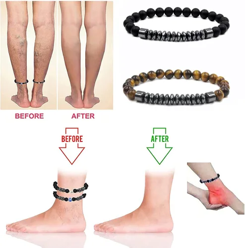 Vista 2 de INENIMARTJ Tobillera de obsidiana negra antihinchazón, terapia magnética, pulsera de tobillo de obsidiana negra para mujeres y hombres, pulsera