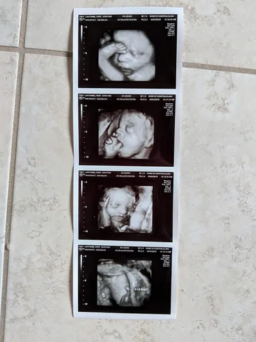 Vista 2 de Broma 3D personalizada tira de ultrasonido falso de 4 fotos