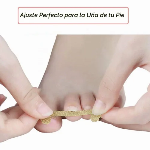 Vista 2 de EBANKU Tiras de tratamiento de uñas encarnadas, 20 piezas de parche de corrección de uñas de los pies, parche elástico, corrector de pedicura