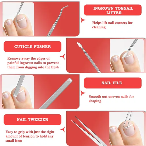 Vista 7 de Kit de eliminación de uñas encarnadas, tratamiento profesional de uñas encarnadas, kit de herramientas de uñas encarnadas con gotas correctoras