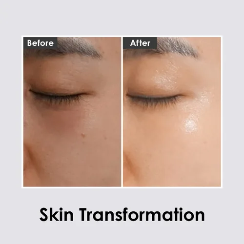 Vista 5 de MEDI-PEEL Parche para ojos de ampolla Peptide9 (Hyaluron Dark Benone)