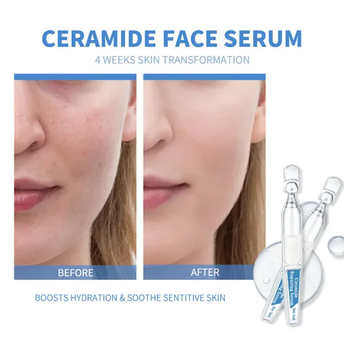 Vista 3 de Suero de ampolla de ceramida con ácido hialurónico, péptido, hidratante y antienvejecimiento, suero facial de reparación de barrera cutánea