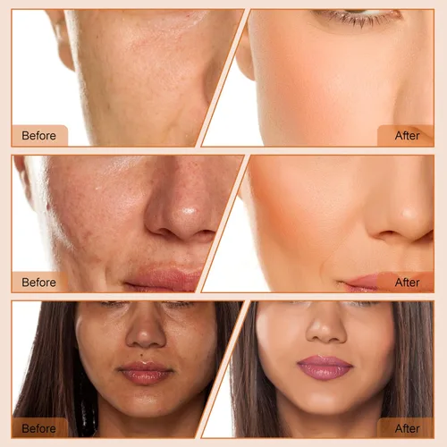 Vista 8 de 4 en 1 Dermoabrasión de diamante Microdermabrasión Limpiador de la piel Vacío Facial Peeling Rociador Blackhead Removedor de acné Cuidado de la piel