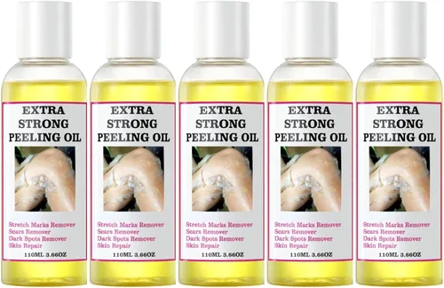 Vista 10 de Aceite de pelado amarillo, aceite de pelado fuerte para piel oscura, extra fuerte, solución exfoliante para el cuerpo, todo tipo de piel, removedor