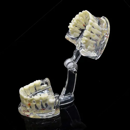Vista 5 de Modelo de dientes para niños,Modelo de dientes de demostración dental transparente,Modelo de enseñanza de Typodont
