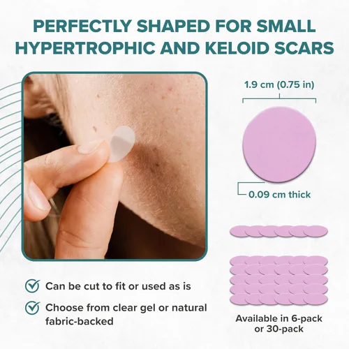 Vista 6 de Epi-Derm Epi-Tab Circles - Láminas de silicona para cicatrices – Parches de silicona lavables y reutilizables de grado profesional, para pequeñas